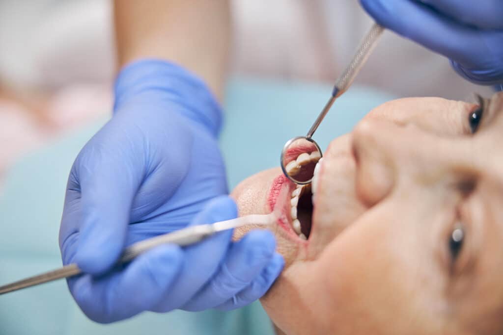 Am I a Candidate for Dental Implants?