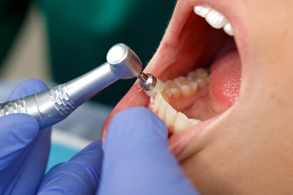 Dental Exam vs. Dental Cleaning: What's the Difference?